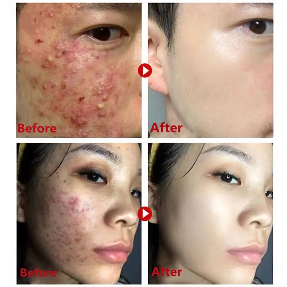 Green Tea Facial Mask Remove Acne Deep Cleaning Purifying Clay Facial Mask Oil Control Solid Facial Mask Moisturizing Skin Care